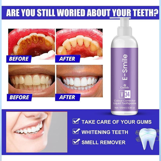 E-Smile Colour Corrector Liquid Toothpaste 200ml Pack of 2